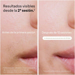 V4HD6AF8750224F815637941C3CF0ADAE63R6739149P3